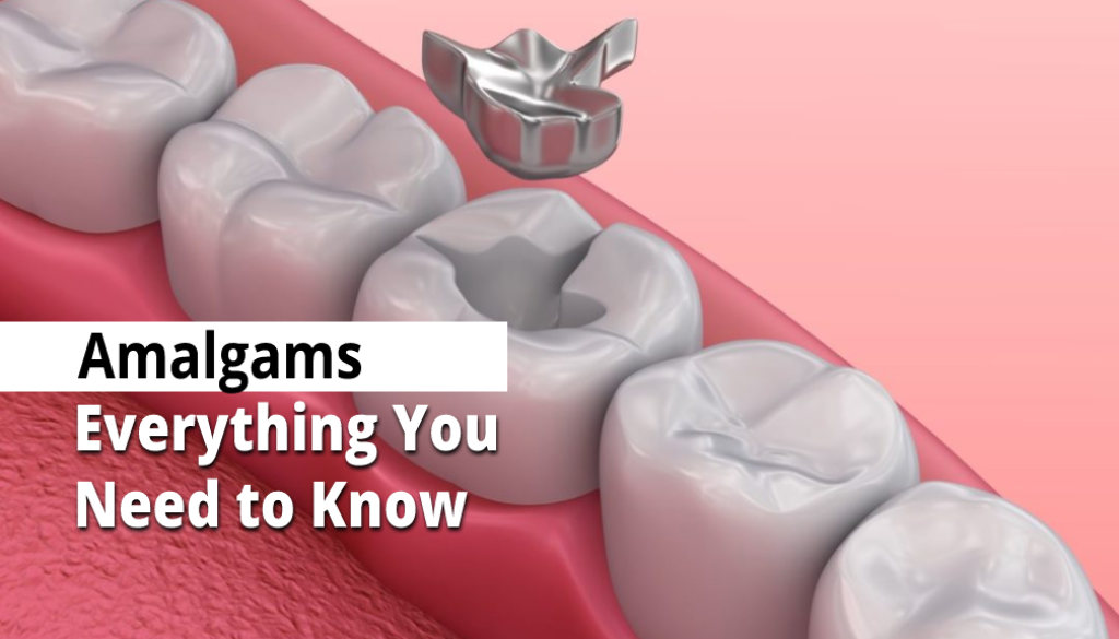Amalgams: Everything you need to know