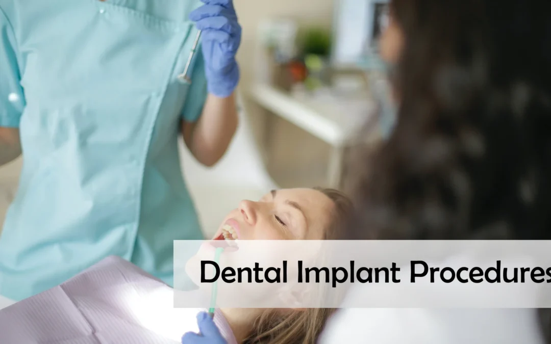 Dental Implant Procedures