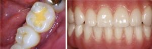 dental-intraoral_camera-300x97
