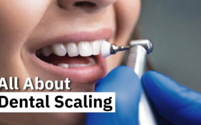 All about Dental Scaling