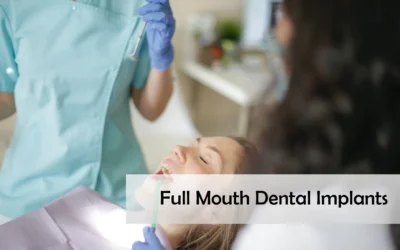 Full Mouth Dental Implants