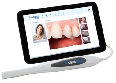 mouthwatch-intraoralcamera
