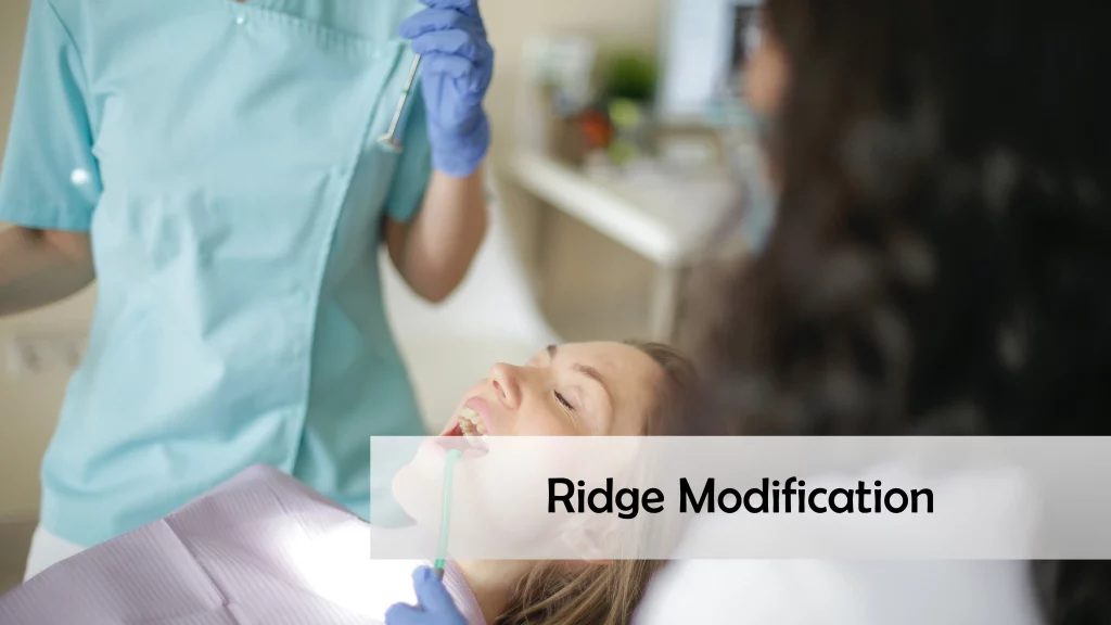 Ridge Modification