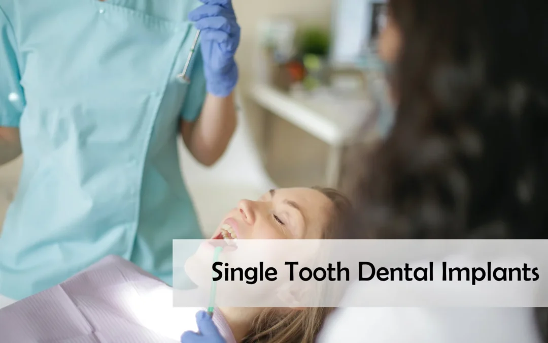 Single Tooth Dental Implants